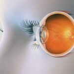 أسباب ضمور اعصاب العين