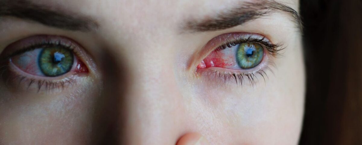 التهاب العين البكتيري