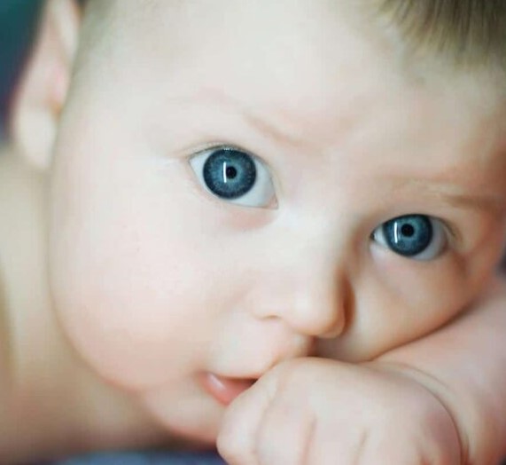 جلوكوما الاطفال