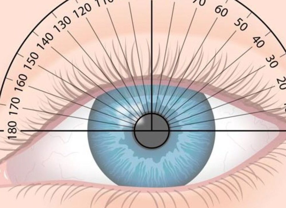 الاستجماتيزم الطبيعي