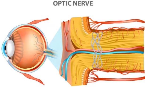امراض عصب العين