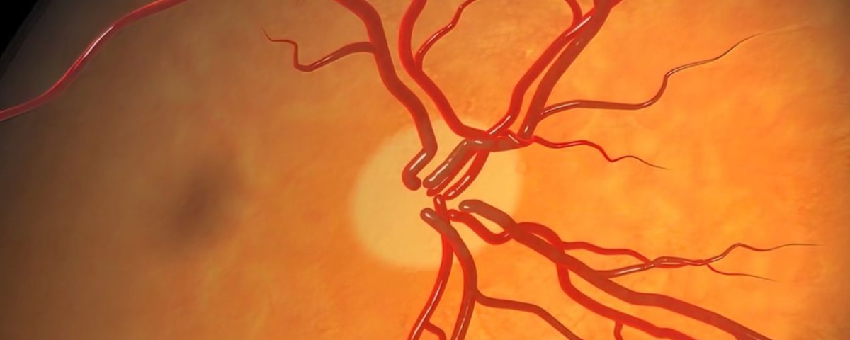 امراض عصب العين