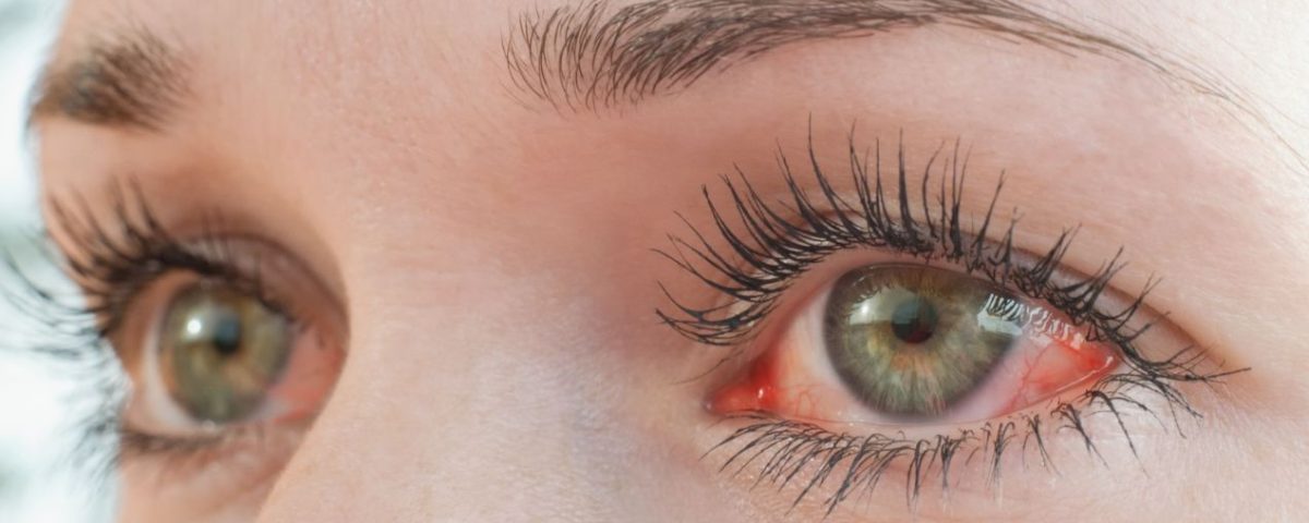 اعراض ارتفاع ضغط الدم العصبي