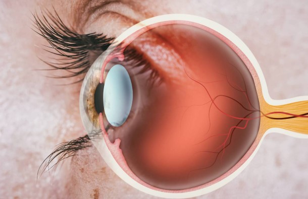 اعراض ارتفاع ضغط الدم العصبي