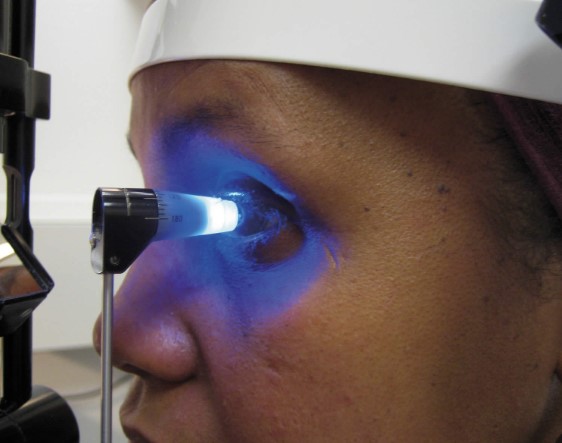 اعراض ارتفاع ضغط الدم العصبي