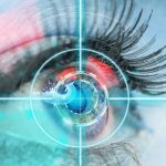 الليزر النبضي Micropulse