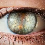 حثل القرنية