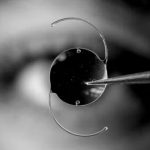 عدسات EDOF و LAL