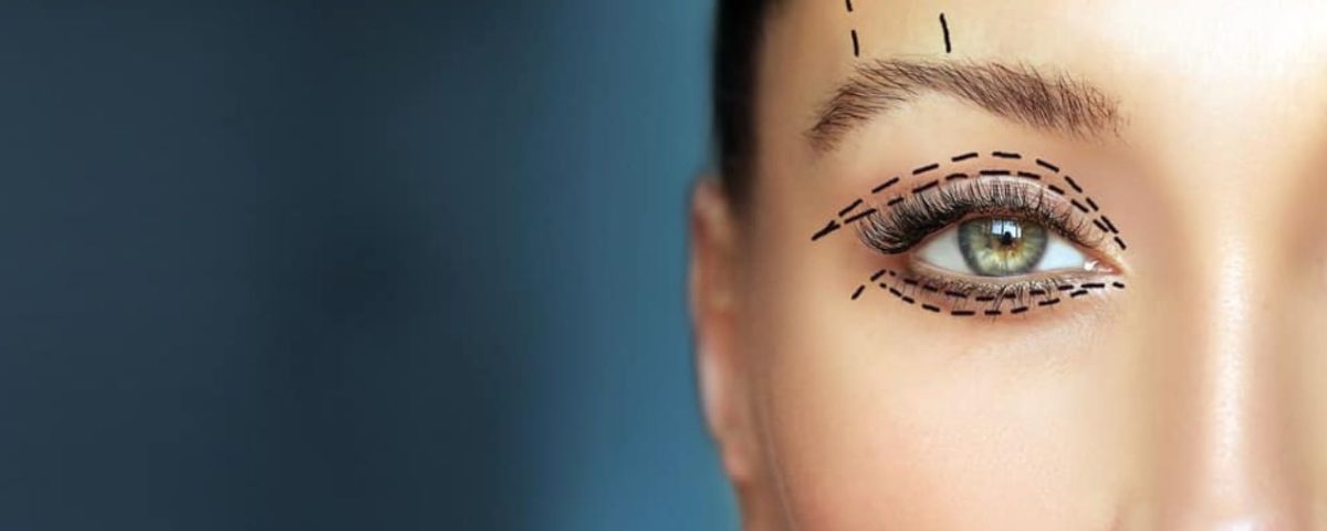 تدلي الجفون