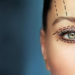 تدلي الجفون