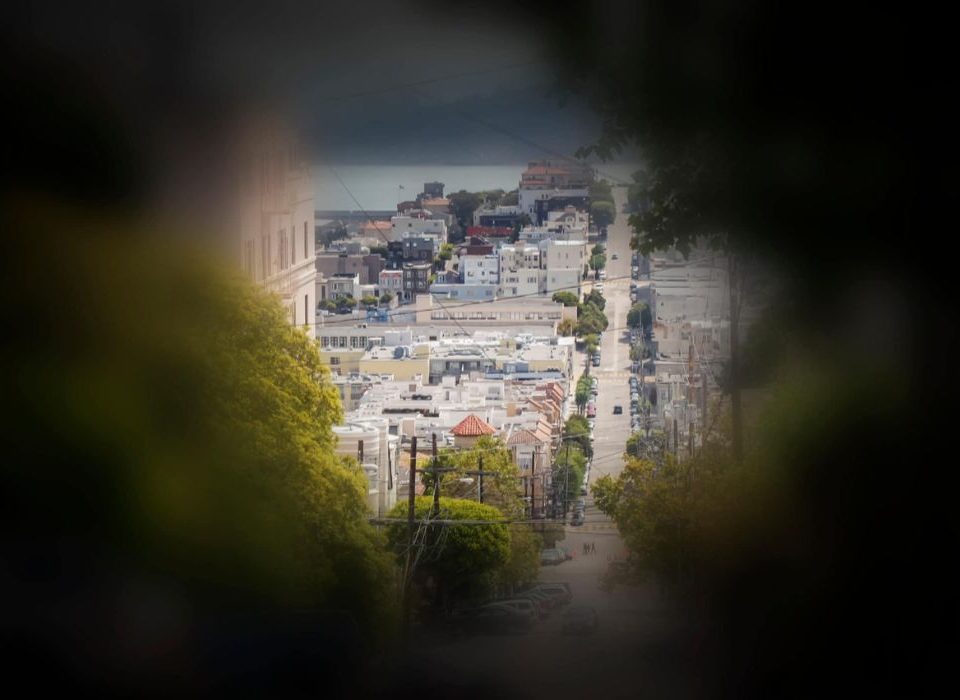 متلازمة آشر Usher Syndrome