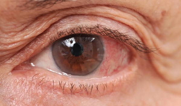 منظار العين