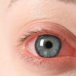 اعراض ارتفاع ضغط العين