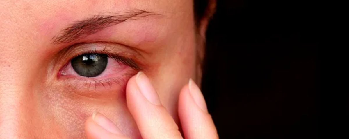 العين المتراكمة