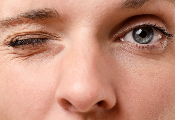 رفرفة العين