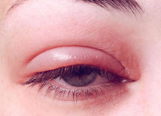 اسباب وجع العين