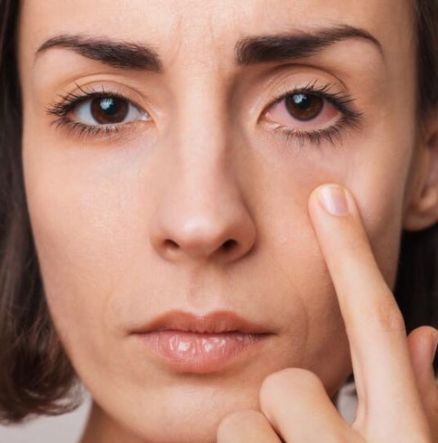 نقطة حمراء بالعين