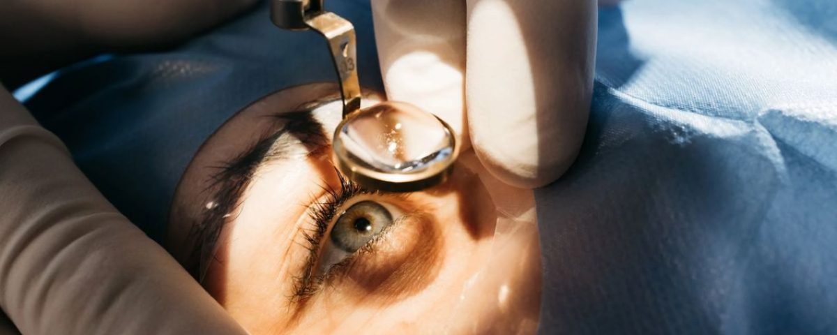 زراعة عدسه للعين