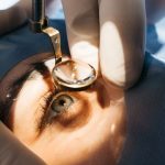 زراعة عدسه للعين