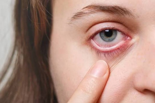 رؤية هالات حول الضوء
