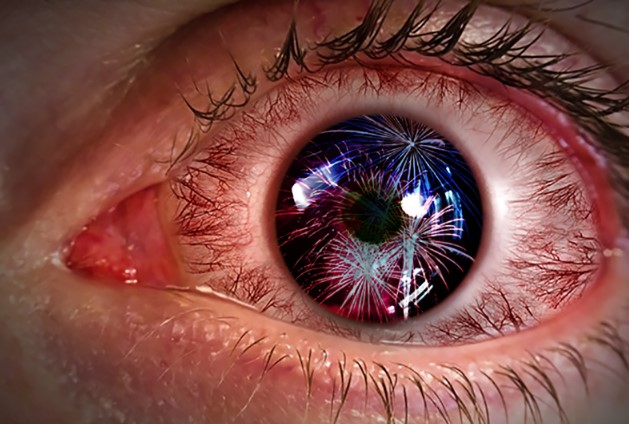 حماية العين من الألعاب النارية والاحتفالات