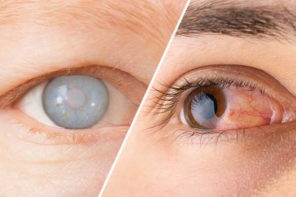 الفرق بين الماء الأزرق والماء الأبيض