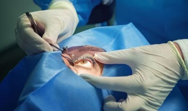 من هو المرشح المناسب لعملية تصحيح النظر؟