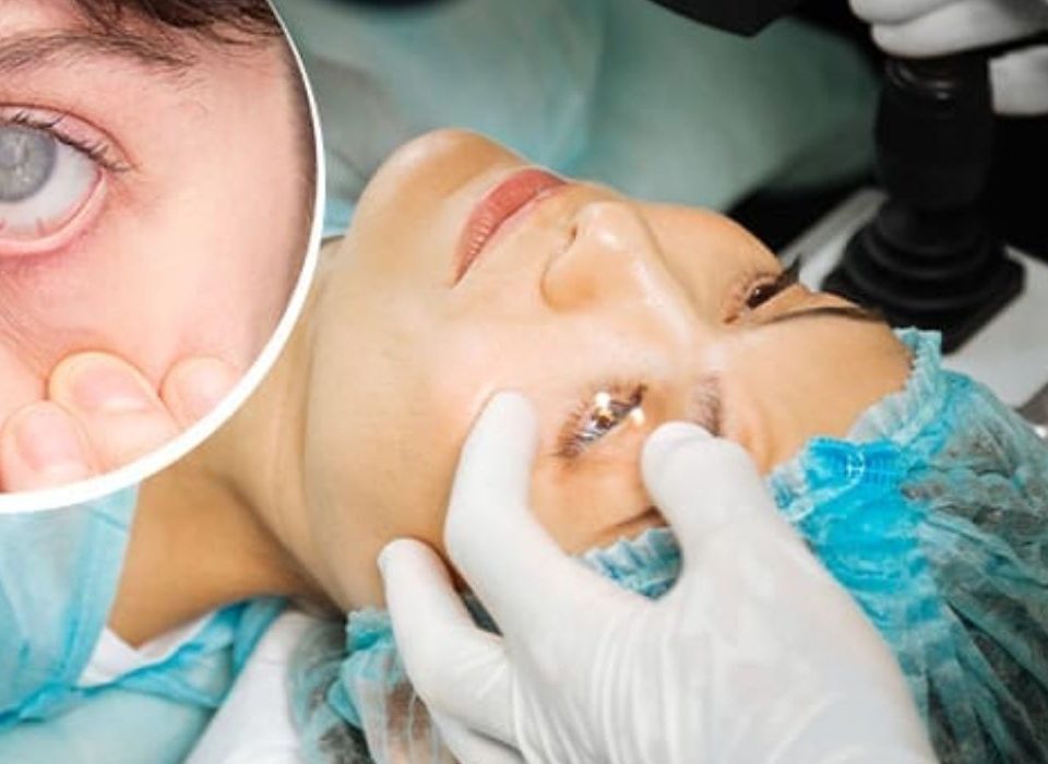 متى تحتاج عملية المياه البيضاء